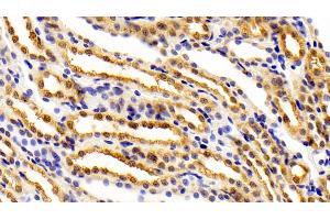 Detection of FEz2 in Rat Kidney Tissue using Polyclonal Antibody to Fasciculation And Elongation Protein Zeta 2 (FEz2)