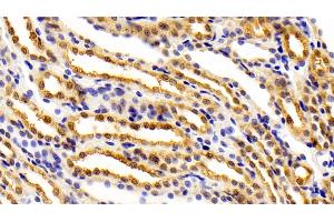 Detection of FEz2 in Rat Kidney Tissue using Polyclonal Antibody to Fasciculation And Elongation Protein Zeta 2 (FEz2) (FEZ2 anticorps  (AA 1-375))