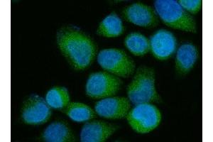 IF analysis of OS9 using anti-OS9 antibody (ABIN7602048). (OS9 anticorps  (AA 56-635))