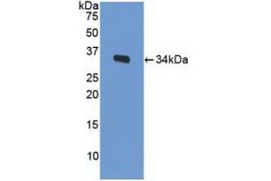 Detection of Recombinant LRP1, Mouse using Polyclonal Antibody to Low Density Lipoprotein Receptor Related Protein 1 (LRP1) (LRP1 anticorps  (AA 692-962))