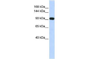WB Suggested Anti-EVI1 Antibody Titration: 0. (MECOM anticorps  (Middle Region))