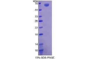 SDS-PAGE analysis of Human AGK Protein.