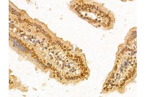anti-F-Box and WD Repeat Domain Containing 2 (FBXW2) (C-Term) antibody