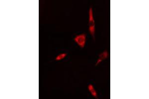 ABIN6268964 staining 293 cells by IF/ICC. (Caspase 1 anticorps  (C-Term))