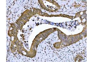 IHC analysis of PSMB4 using anti-PSMB4 antibody (ABIN7600532).