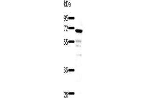 Gel: 8+10+12 % SDS-PAGE, Lysate: 60 μg, Lane: Human fetal kidney tissue, Primary antibody: ABIN7192878(TRAF3 Antibody) at dilution 1/500, Secondary antibody: Goat anti rabbit IgG at 1/8000 dilution, Exposure time: 40 seconds (TRAF3 anticorps)