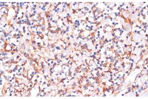 Immunohistochemistry of paraffin-embedded Human tonsil using IKK alpha Polyclonal Antibody at dilution of 1:100 (40x lens). (IKK alpha anticorps)