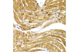 Immunohistochemistry of paraffin-embedded Mouse heart using CSRP3 antibody at dilution of 1:100 (x400 lens). (CSRP3 anticorps)