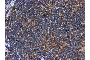 Image no. 13 for anti-Proteasome (Prosome, Macropain) Subunit, beta Type, 9 (Large Multifunctional Peptidase 2) (PSMB9) (AA 21-219) antibody (ABIN1491194)