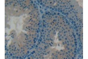 Detection of OC in Mouse Testis Tissue using Polyclonal Antibody to Osteocalcin (OC)