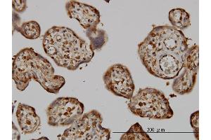 Immunoperoxidase of monoclonal antibody to NME1 on formalin-fixed paraffin-embedded human placenta.