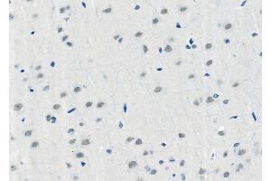 ABIN6257957 and ABIN6275973 at 1/100 staining Rat brain tissue by IHC-P. (BAI1 anticorps  (Internal Region))