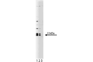 Western blot analysis of Caveolin 1 on a human endothelial lysate. (Caveolin-1 anticorps  (AA 1-97))