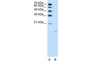 Western Blotting (WB) image for anti-Acid Phosphatase 1, Soluble (ACP1) antibody (ABIN2462541) (ACP1 anticorps)