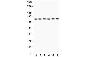 Western blot testing of MFN1 antibody and Lane 1:  rat heart;  2: (r) kidney;  3: mouset heart;  4: human HeLa;  5: (h) COLO320;  6: (h) A549. (MFN1 anticorps  (N-Term))