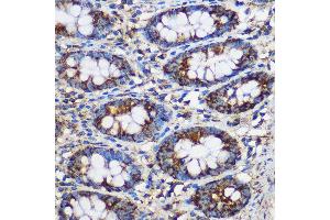Immunohistochemistry of paraffin-embedded Human colon using TEX101 Rabbit pAb (ABIN7270773) at dilution of 1:100 (40x lens). (TEX101 anticorps)