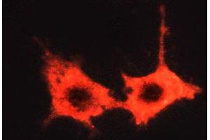ABIN6269062 staining MCF-7 cells by ICC/IF. (JAK2 anticorps  (Internal Region))