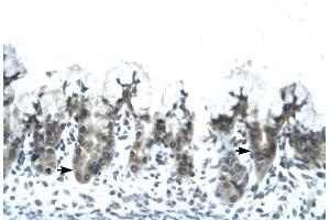 ACDC antibody was used for immunohistochemistry at a concentration of 4-8 ug/ml to stain Epithelial cells of fundic gland (arrows) in Human Stomach. (ADIPOQ anticorps  (N-Term))