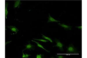 Immunofluorescence of monoclonal antibody to WBP2 on HeLa cell.
