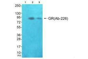 Western blot analysis of extracts from JK cells (Lane 2) and K562 cells (Lane 3), using GR(Ab-226) antiobdy. (Glucocorticoid Receptor anticorps  (Ser226, Ser234, Ser246))