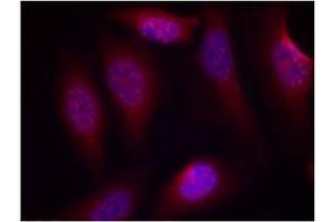 Image no. 3 for anti-Mitogen-Activated Protein Kinase Kinase 4 (MAP2K4) (pSer80) antibody (ABIN196910)