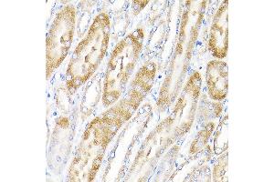 Immunohistochemistry of paraffin-embedded mouse kidney using IKBKAP Rabbit pAb (ABIN6130369, ABIN6142278, ABIN6142279 and ABIN6214265) at dilution of 1:100 (40x lens). (IKAP/p150 anticorps  (AA 1093-1332))