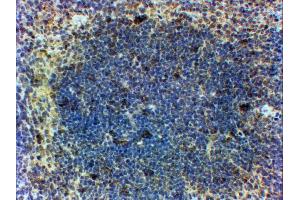 In paraffin embedded Mouse Spleen shows patches of stained cells in the Germinal Centre.