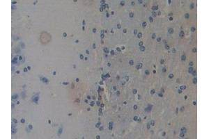 Detection of REG3b in Mouse Cerebrum Tissue using Polyclonal Antibody to Regenerating Islet Derived Protein 3 Beta (REG3b) (REG3B anticorps  (AA 27-175))