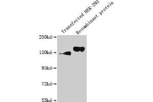 Western Blot Positive WB detected in: 293T whole cell lysate transfected with SEMA4D, Recombinant proteins with SEMA4D All lanes: SEMA4D antibody at 1:1000 Secondary Goat polyclonal to mouse IgG at 1/50000 dilution Predicted band size: 130, 150 KDa Observed band size: 130, 150 KDa Exposure time:5 min
