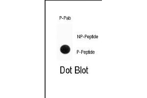Dot blot analysis of anti-Phospho-ENT1(Slc29a1)-p Antibody (ABIN389998 and ABIN2839775) on nitrocellulose membrane. (SLC29A1 anticorps  (pSer254))