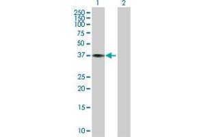 Western Blot analysis of CTSK expression in transfected 293T cell line by CTSK MaxPab polyclonal antibody. (Cathepsin K anticorps  (AA 1-329))