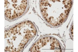 Immunoperoxidase of purified MaxPab antibody to GAGE1 on formalin-fixed paraffin-embedded human testis.