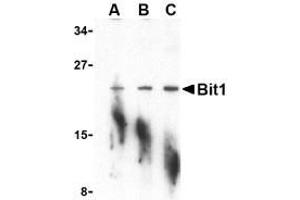 Western blot analysis of Bit1 in A-20 cell lysate with AP30152PU-N Bit1 antibody at (A) 1, (B) 2, and (C) 4 μg/ml. (PTRH2 anticorps  (N-Term))