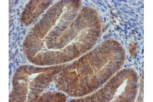 Image no. 6 for anti-Mannose Phosphate Isomerase (MPI) antibody (ABIN1499545) (MPI anticorps)