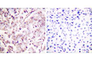 P-peptide - + (ETS1 anticorps  (pThr38))