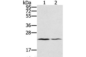 Western Blot analysis of Human normal right lung and normal left lung tissue using EDN2 Polyclonal Antibody at dilution of 1:600 (Endothelin 2 anticorps)