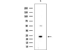 anti-RAP2B, Member of RAS Oncogene Family (RAP2B) (Internal Region) antibody