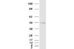 Validation with Western Blot