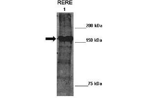 Lanes :  Lane 1: 10ug mouse ATN2 transfected Drosophila extract   Primary Antibody Dilution :   1:100    Secondary Antibody :  Anti-rabbit-HRP   Secondary Antibody Dilution :   1:2000   Gene Name :  RERE   Submitted by :  Manolis Fanto, King's College London (RERE anticorps  (N-Term))