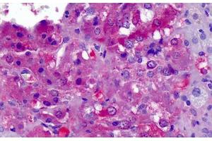 Human Adrenal: Formalin-Fixed, Paraffin-Embedded (FFPE) (APOA2 anticorps  (AA 1-100))