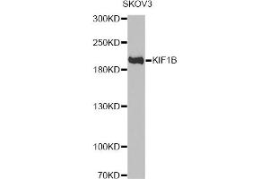 Western blot analysis of extracts of SKOV3 cells, using KIF1B antibody. (KIF1B anticorps)