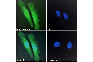 ABIN185127 Immunofluorescence analysis of paraformaldehyde fixed HeLa cells, permeabilized with 0. (Pleckstrin anticorps  (C-Term))