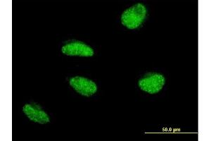 Immunofluorescence of monoclonal antibody to MSH5 on HeLa cell. (MSH5 anticorps  (AA 736-835))