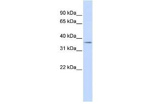 WB Suggested Anti-TRIM69 Antibody Titration:  0. (TRIM69 anticorps  (N-Term))