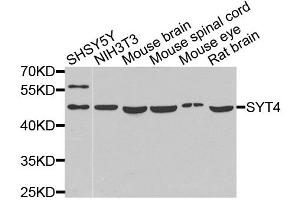 Western blot analysis of extracts of various cell lines, using SYT4 antibody (ABIN5975174) at 1/1000 dilution. (SYT4 anticorps)