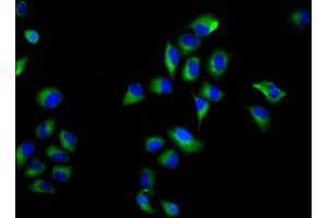 Immunofluorescence staining of Hela cells with ABIN7161019 at 1:66, counter-stained with DAPI. (NOXO1 anticorps  (AA 304-376))