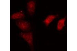 ABIN6274164 staining HeLa cells by IF/ICC. (NR2F6 anticorps  (N-Term))