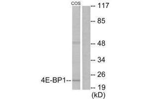 Western blot analysis of extracts from COS7 cells, treated with EGF (200 ng/mL, 30 mins), using 4E-BP1 (Ab-69) antibody. (eIF4EBP1 anticorps  (Thr70))