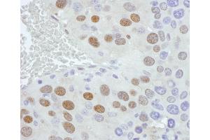 Immunohistochemistry (IHC) image for anti-Phosphate Cytidylyltransferase 1, Choline, alpha (PCYT1A) (AA 1-50) antibody (ABIN7454584) (PCYT1A anticorps  (AA 1-50))