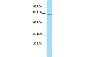 WB Suggested Anti-TBXAS1 Antibody Titration: 1. (TBXAS1 anticorps  (C-Term))